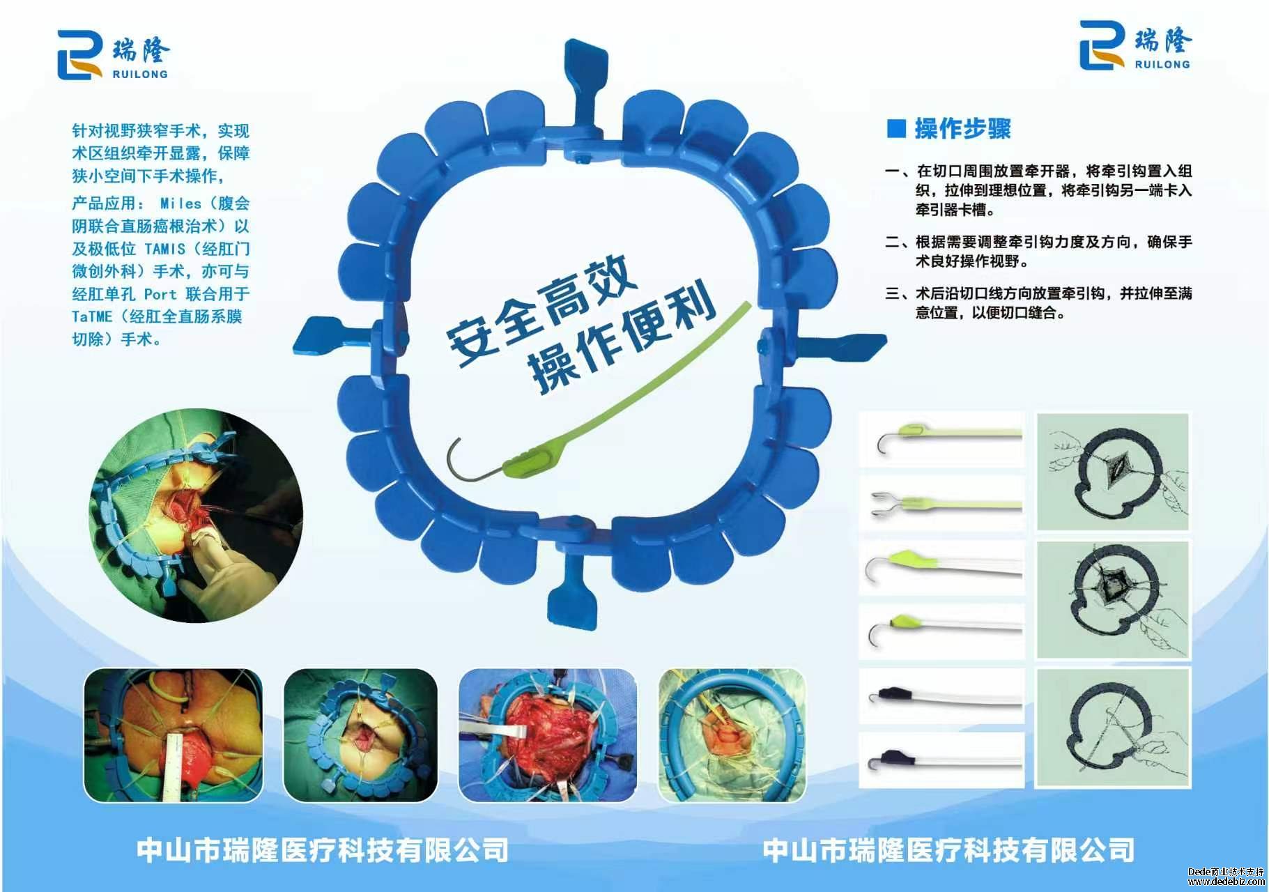 一次性使用无菌软组织扩张器